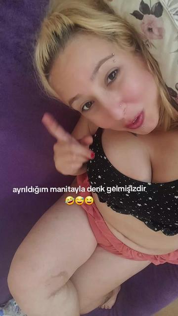 @HEPİNİZE DERT OLACAM BAK GÖR👀