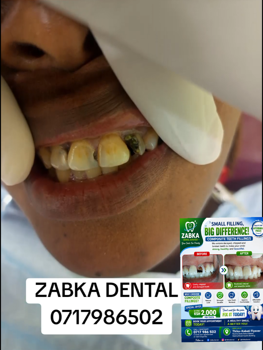 @Zabka Dental