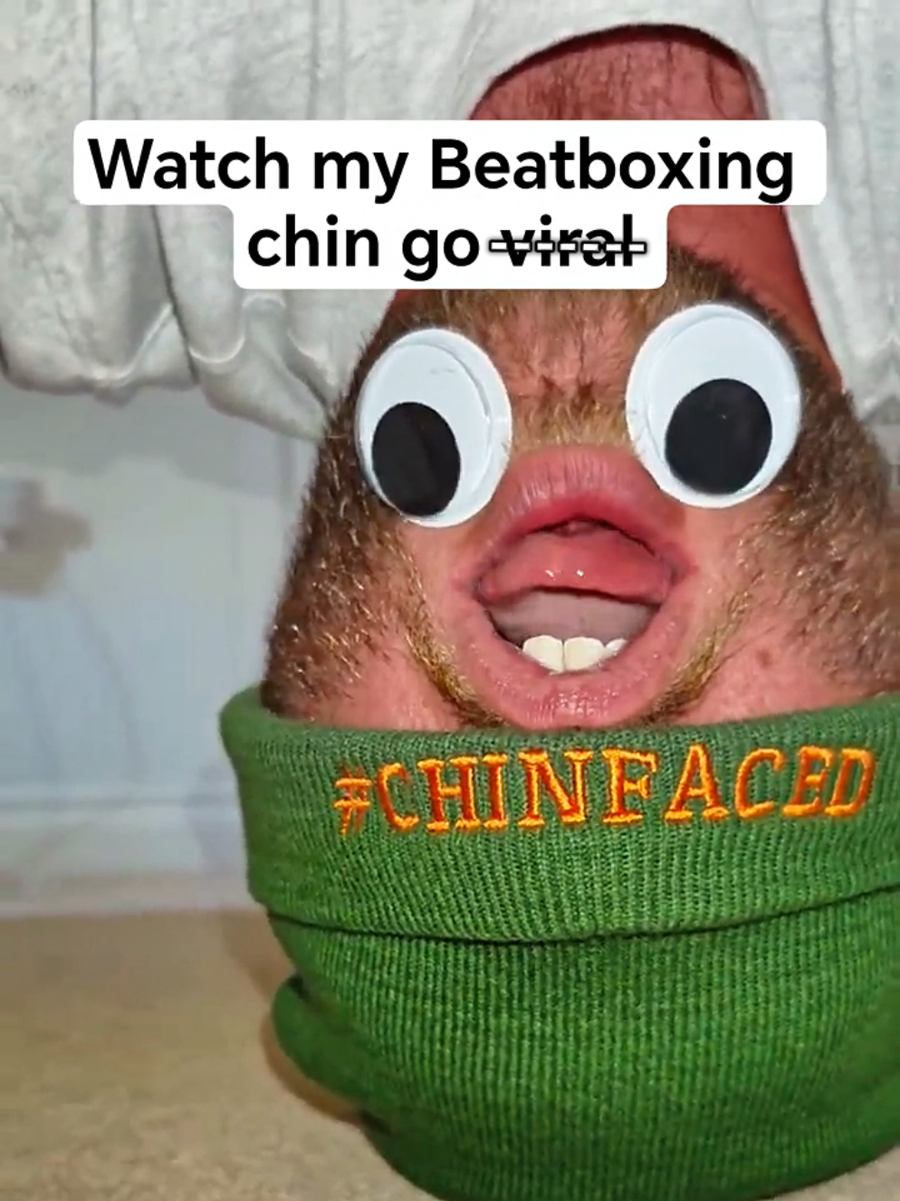 @Chinfaced