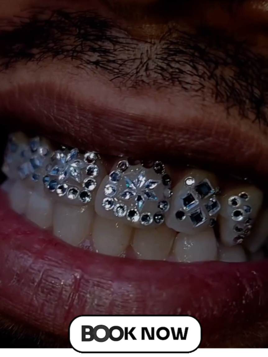 @Pretty Poisons tooth creations