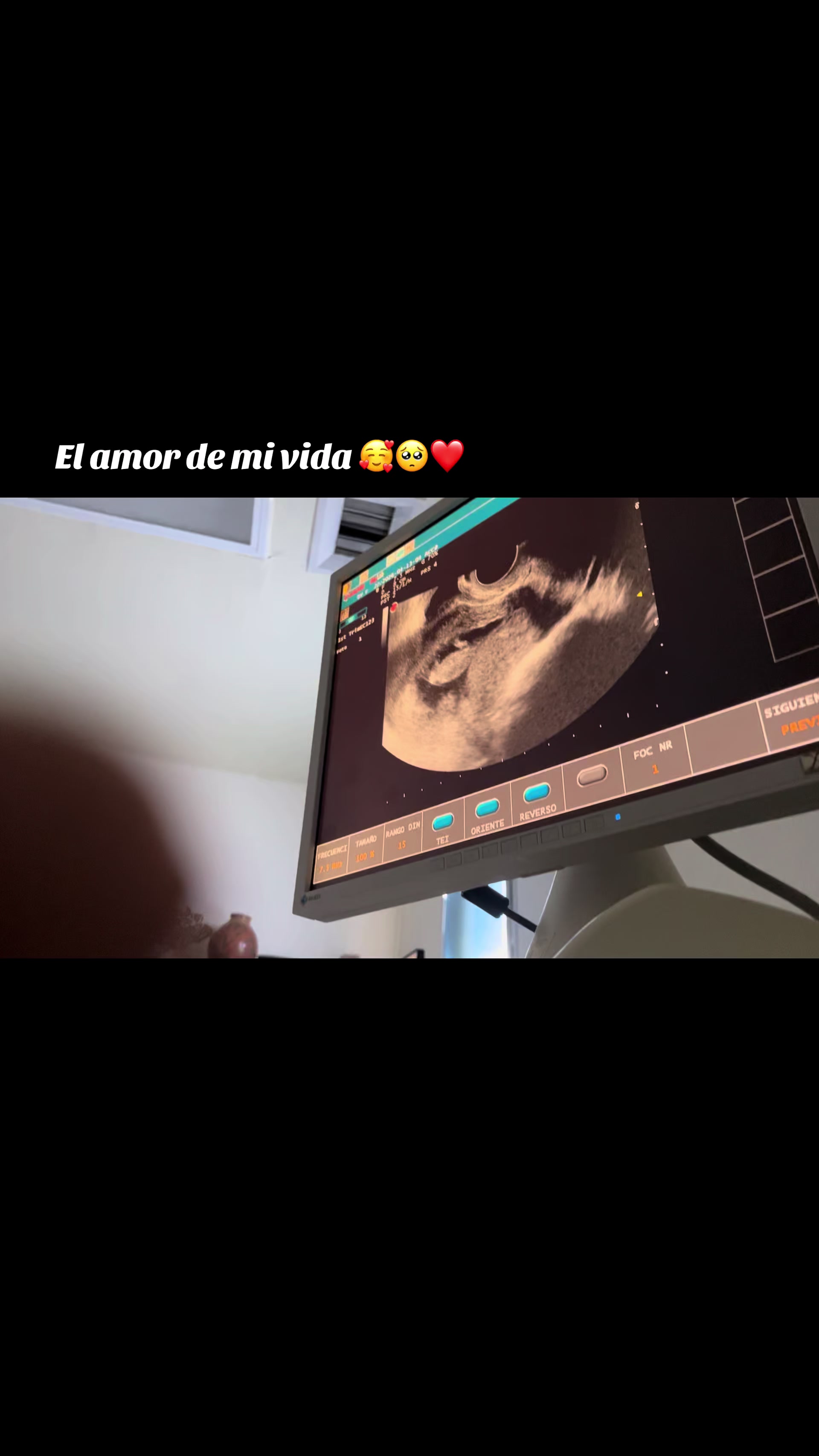 @Guillermina Arana Nayares