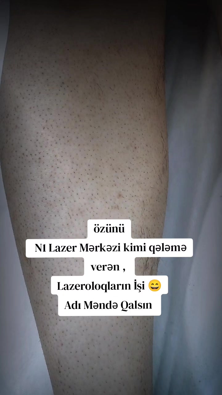 @Dr.Lale.Lazeroloq