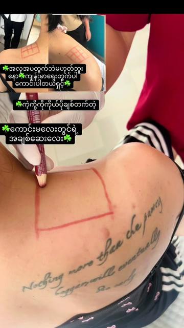 @JaJa (April Nu Beauty Clinic)
