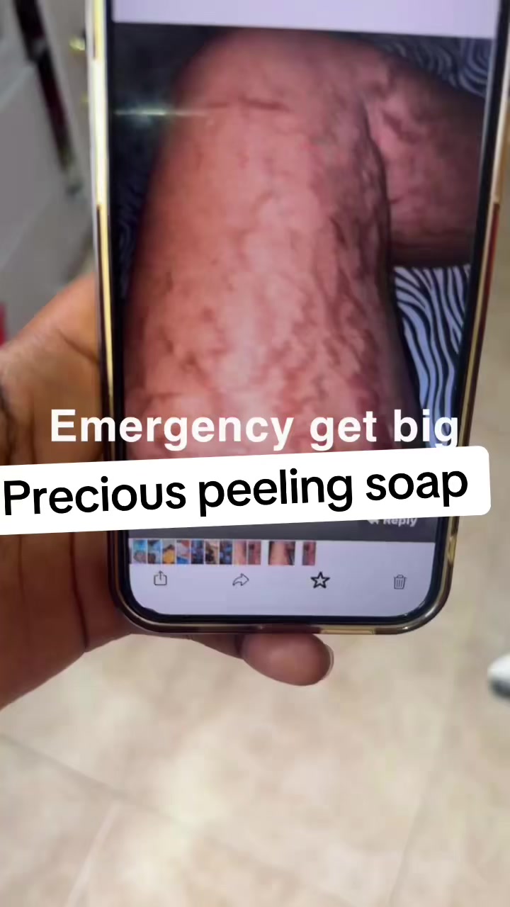 @@ Precious peeling soap