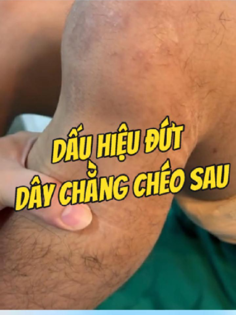 @Chuyên gia xương khớp