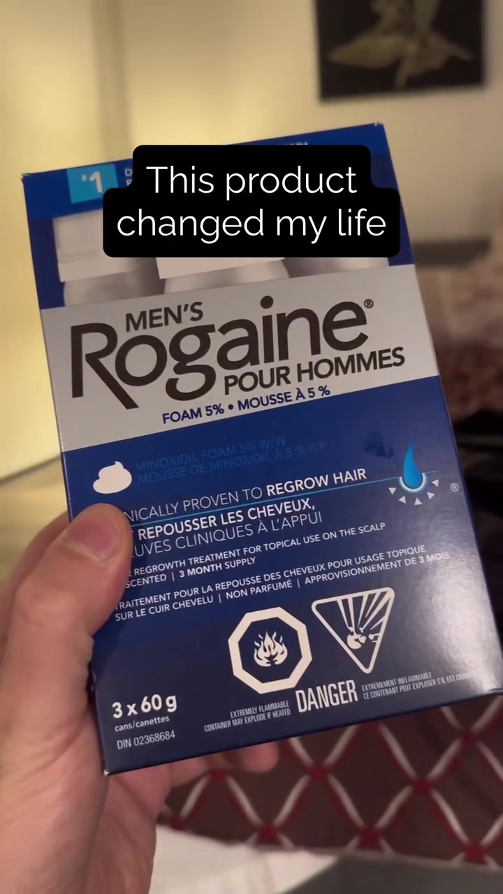 @Nick Milani | 🇨🇦 🇺🇸 Amazon