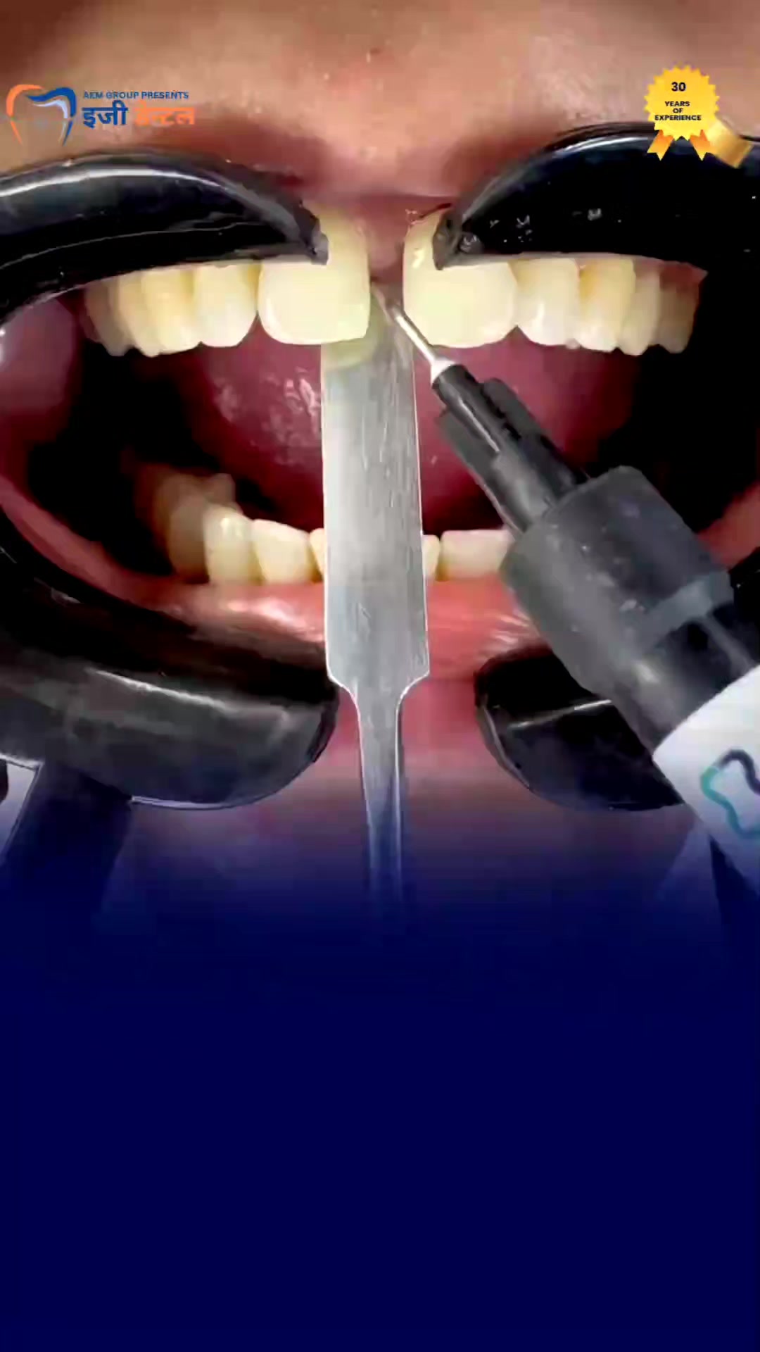 @Easy Dental