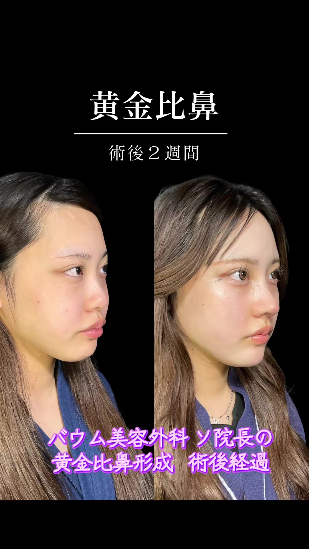 @ソ院長(バウム美容外科/トータル整形)