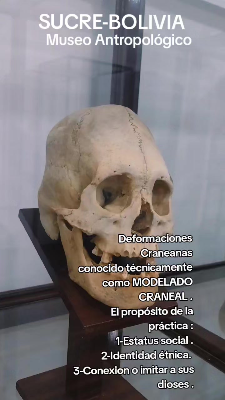 @Javier arte y misterio