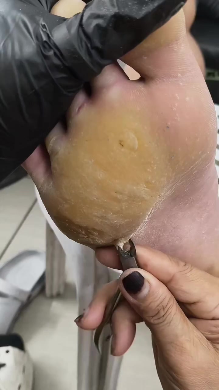 @PodólogosMx