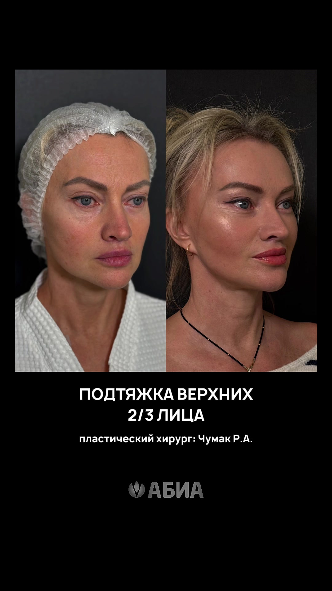 @АБИА