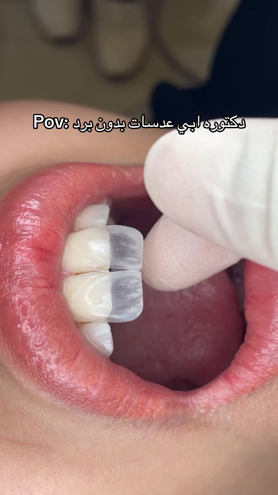 @Dr. Abrar Alhababi