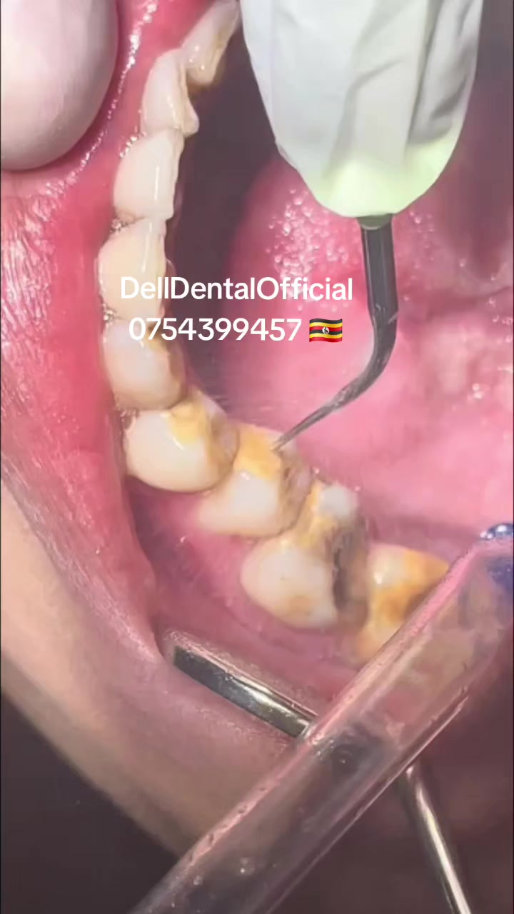 @DellDentalOfficial