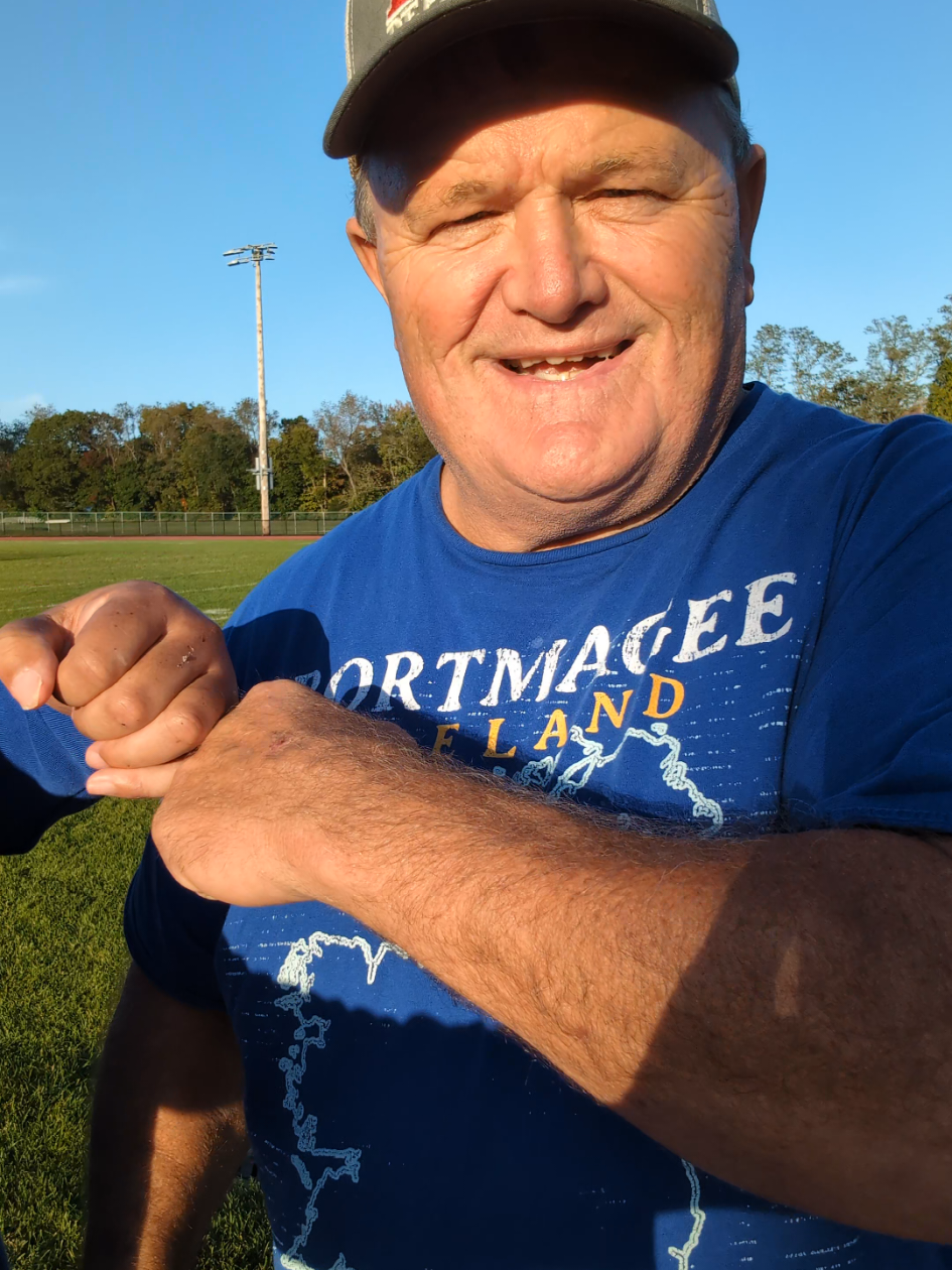 @Stroke SURVIVOR Sal
