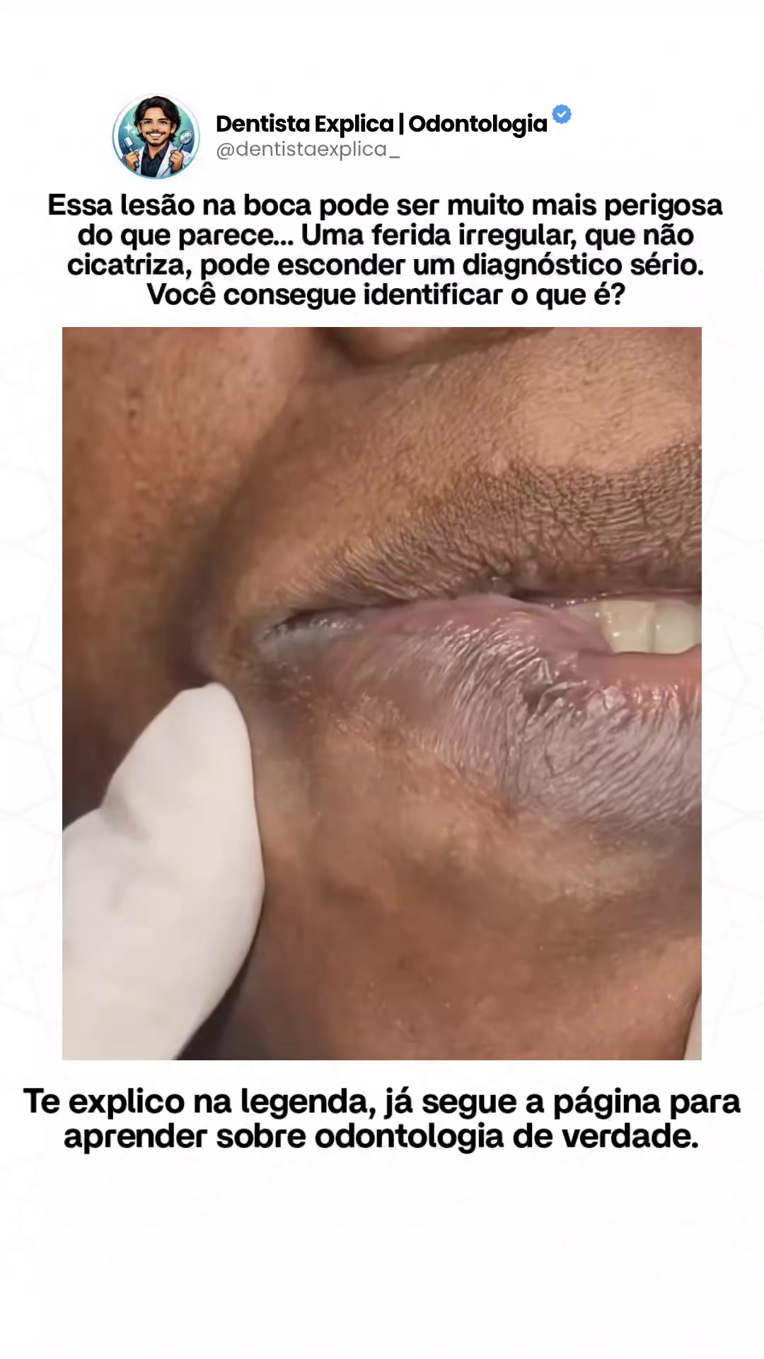 @Dentista Explica | Odontologia