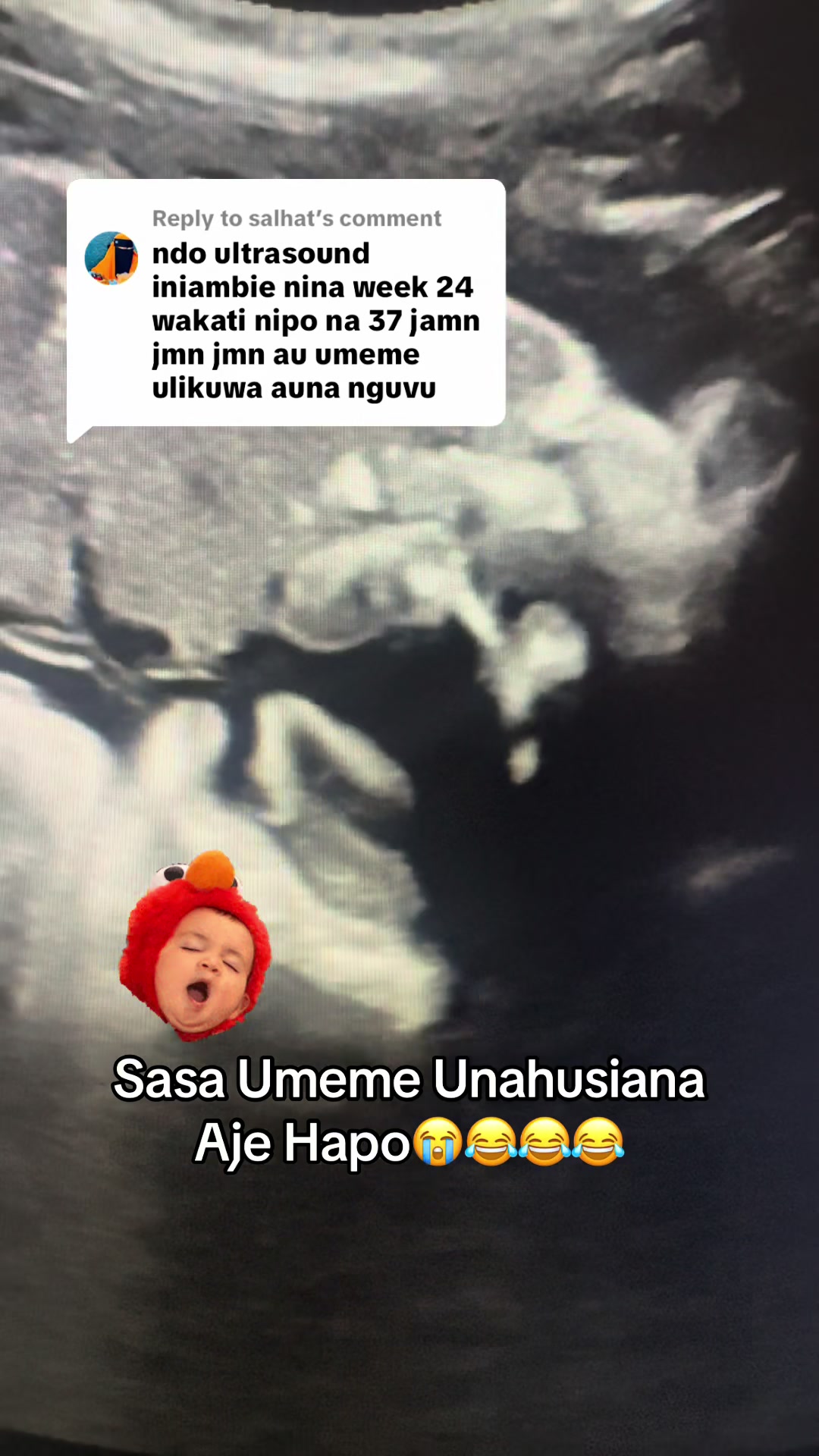 @Radiographer Noah