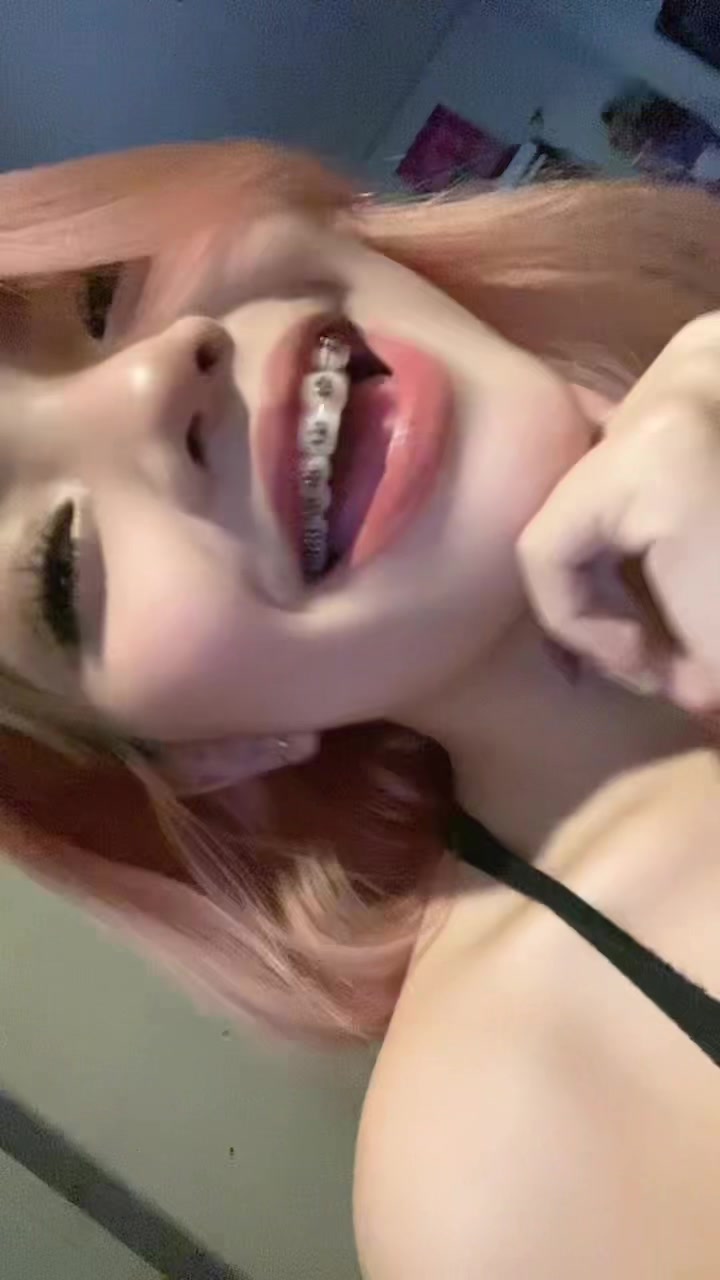 @CHL