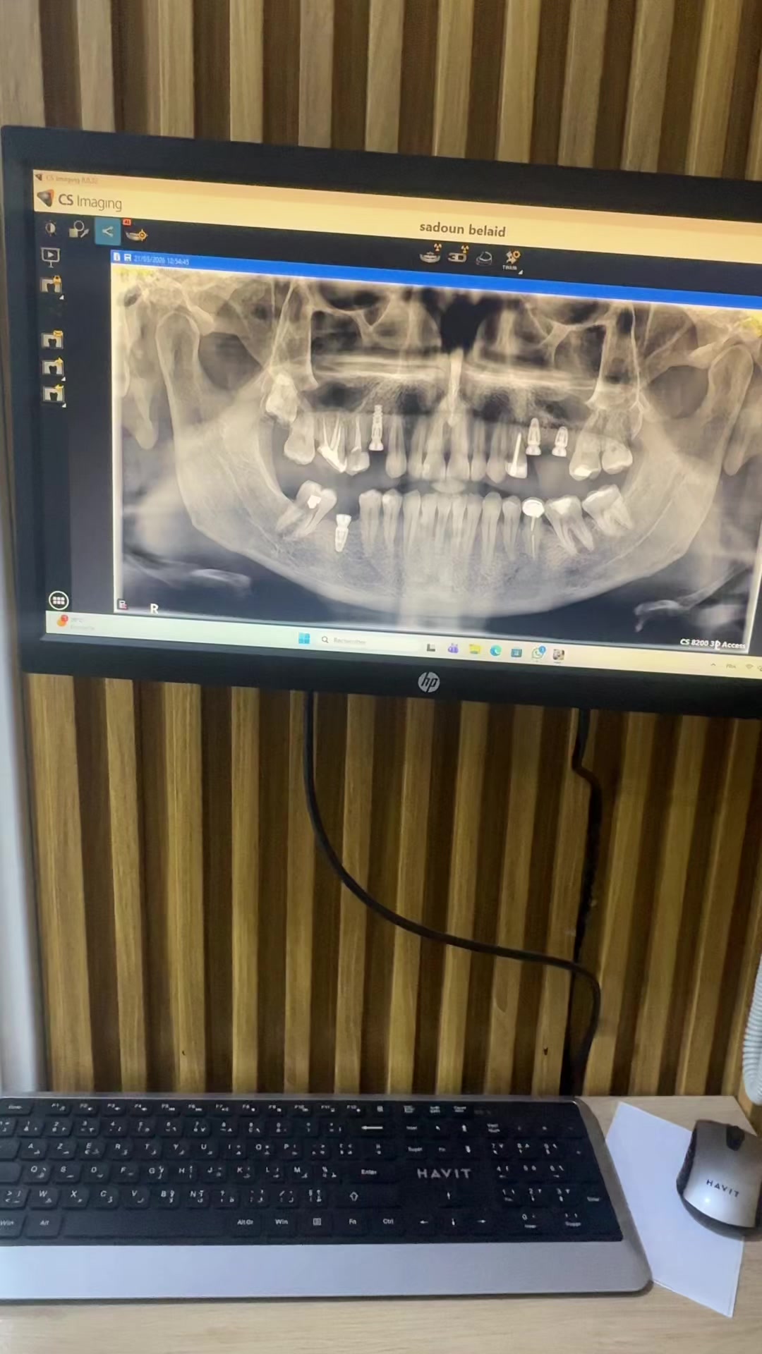 @GOSMILE ROUIBA🇩🇿