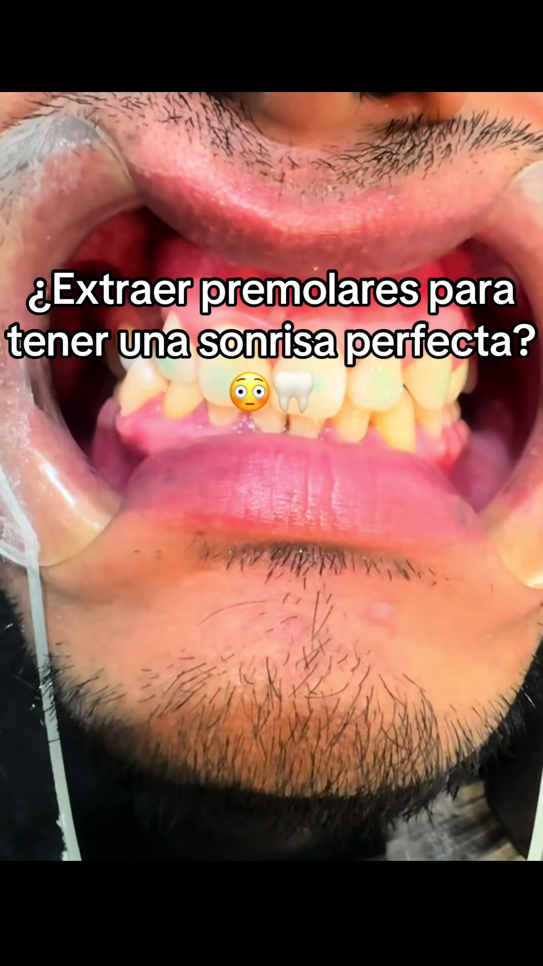 @Dr Cevallos 🦷