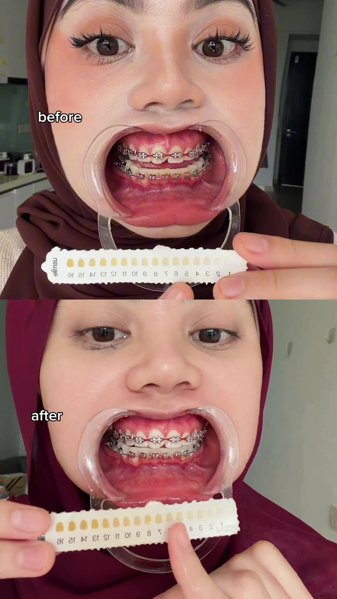 @aini.asyiqinn