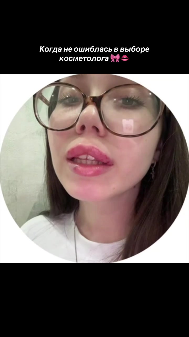 @КОСМЕТОЛОГ • УВЕЛИЧЕНИЕ ГУБ