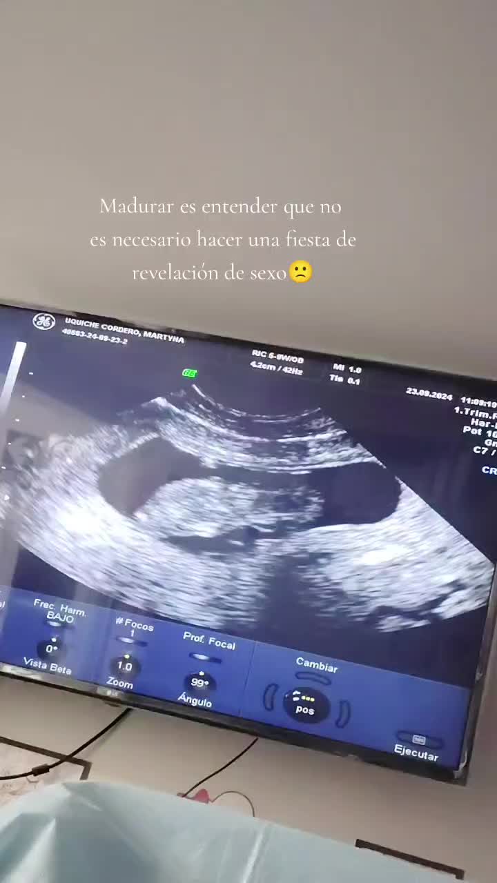 @Antua 🤍