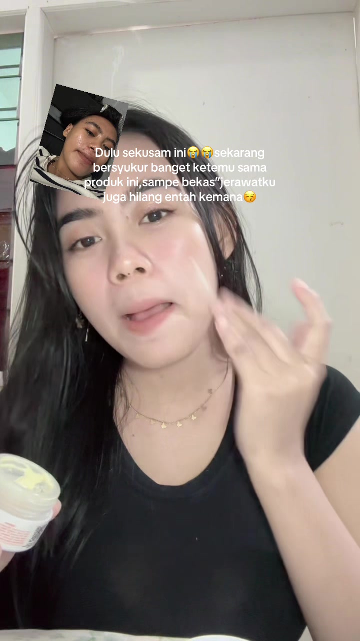 @Cupita