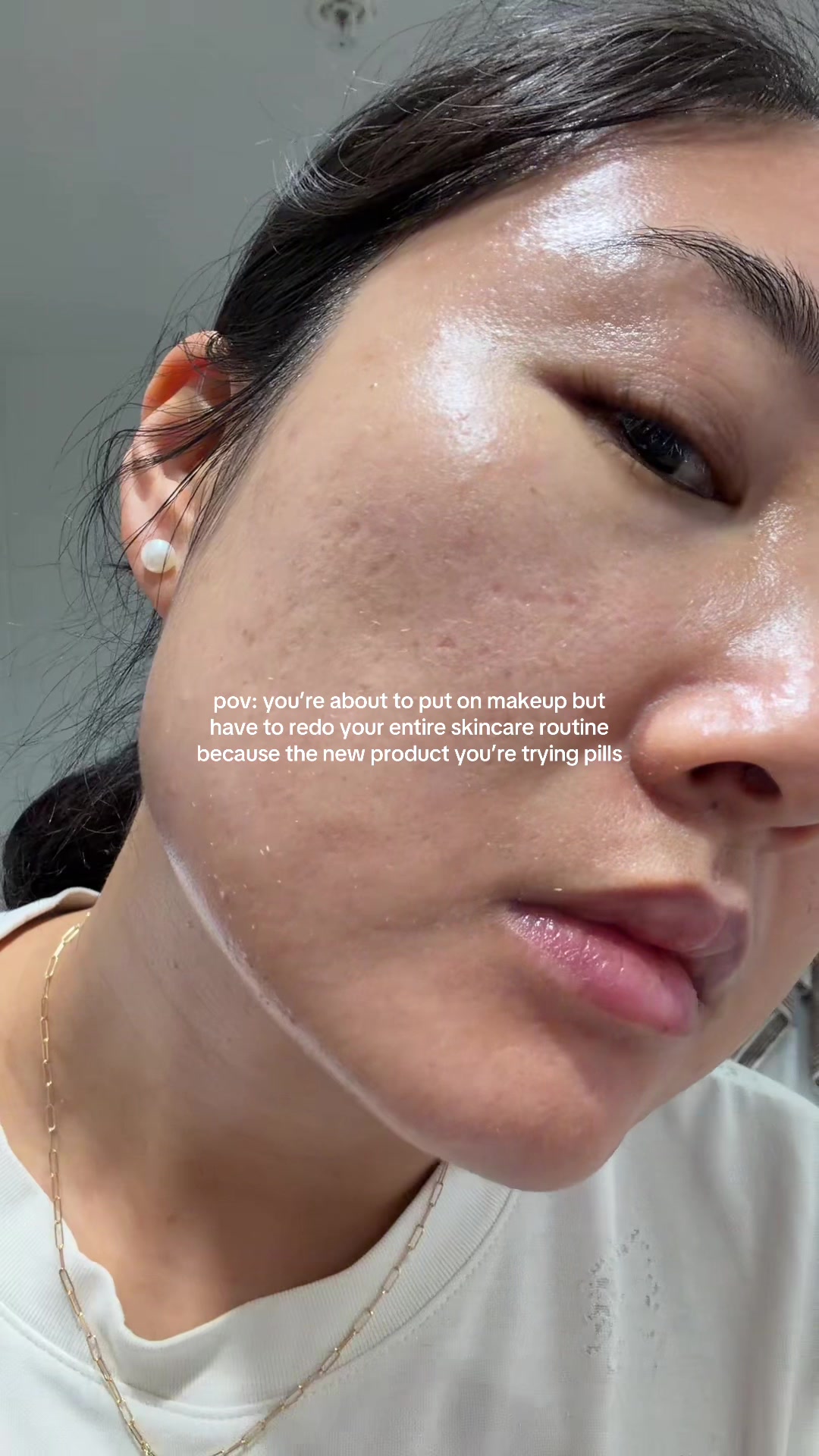 @Lisa | acne → clear skin