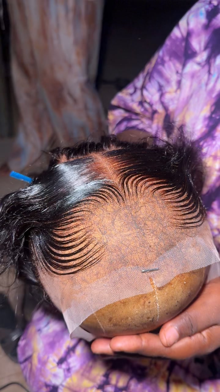 @Williams hairline
