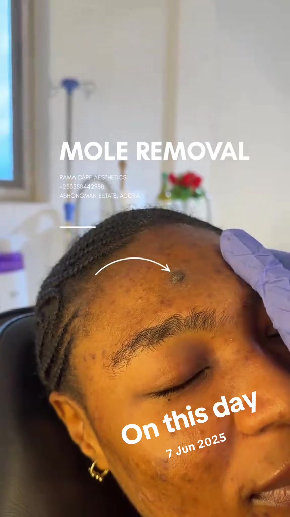 @Rama Care Aesthetics