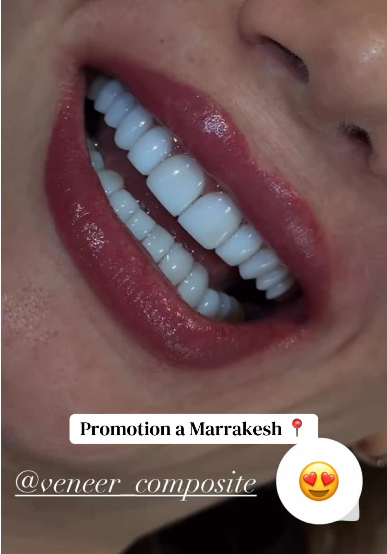 @brightsmileee1