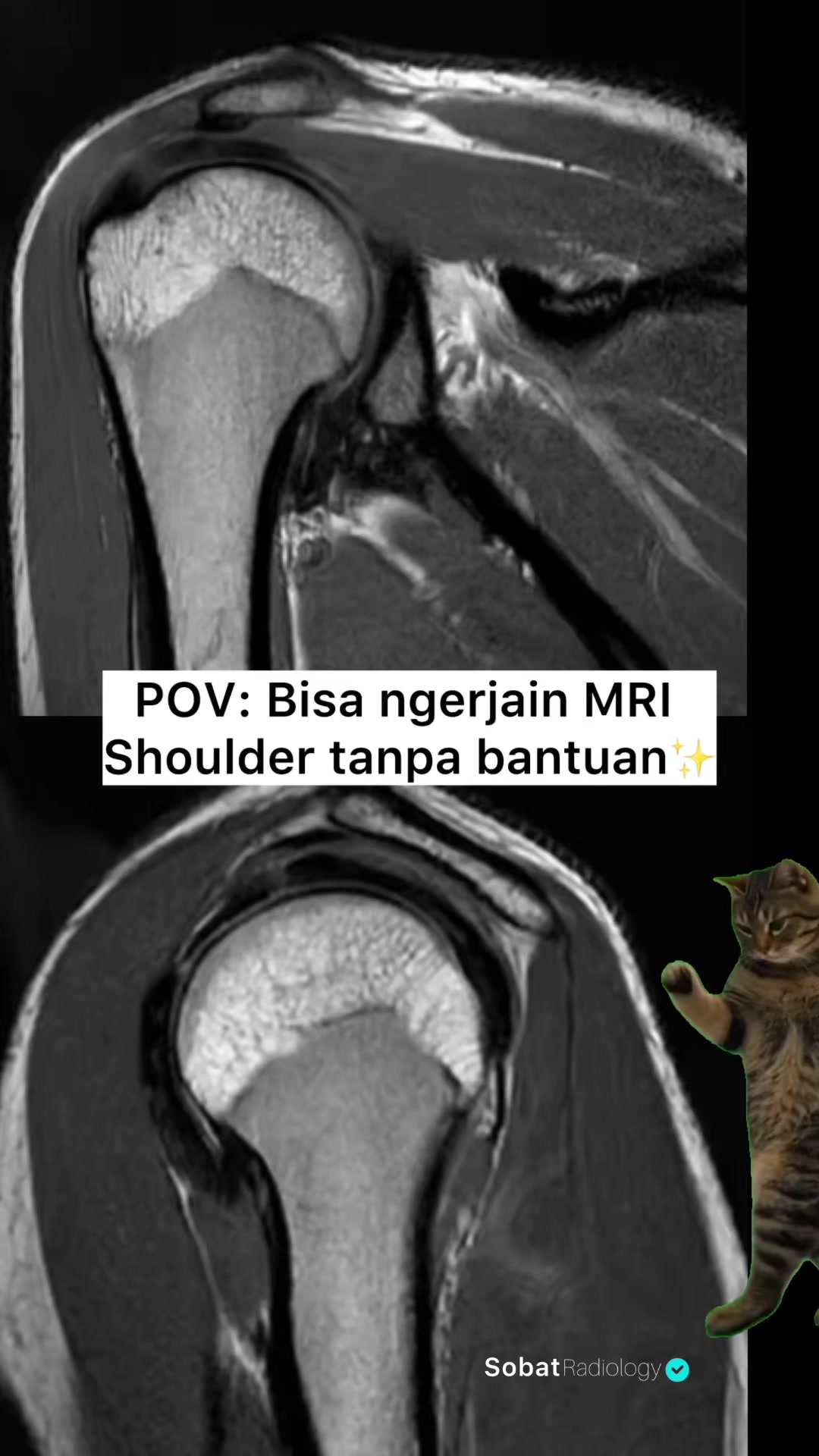 @Sobat Radiology