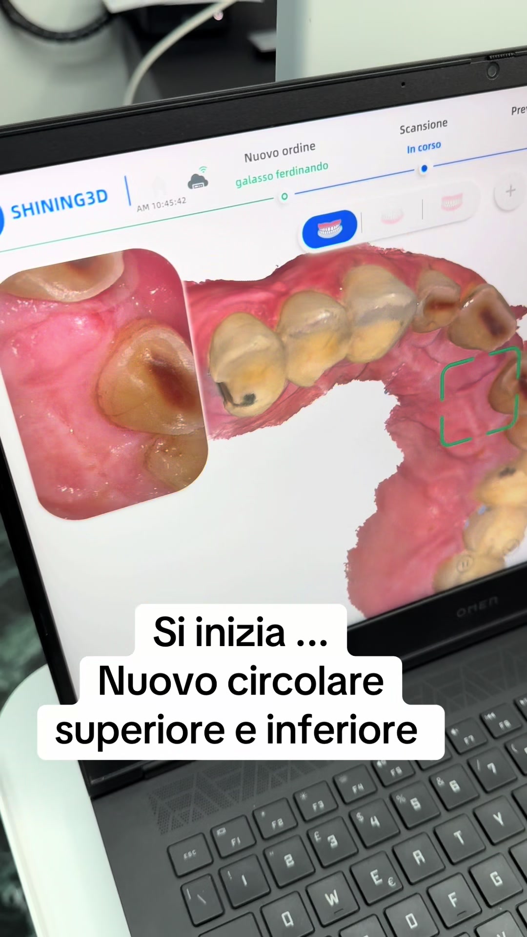 @Dott.RaffaeleNegro 🦷