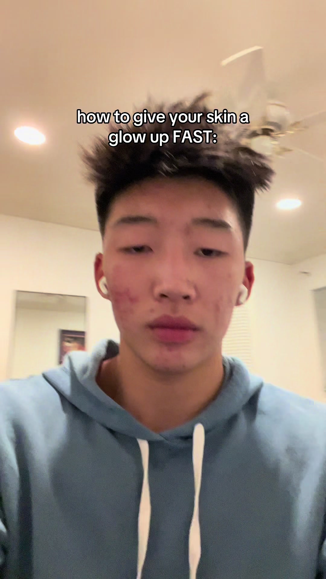 @JUSTIN