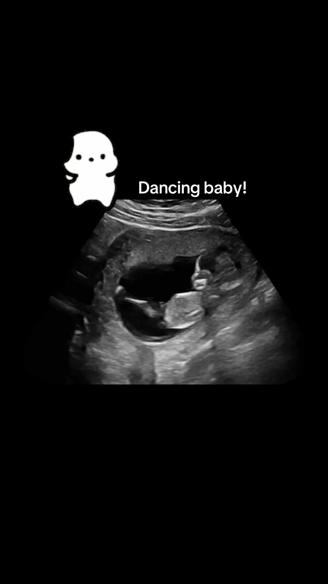 @babyspace3d4d