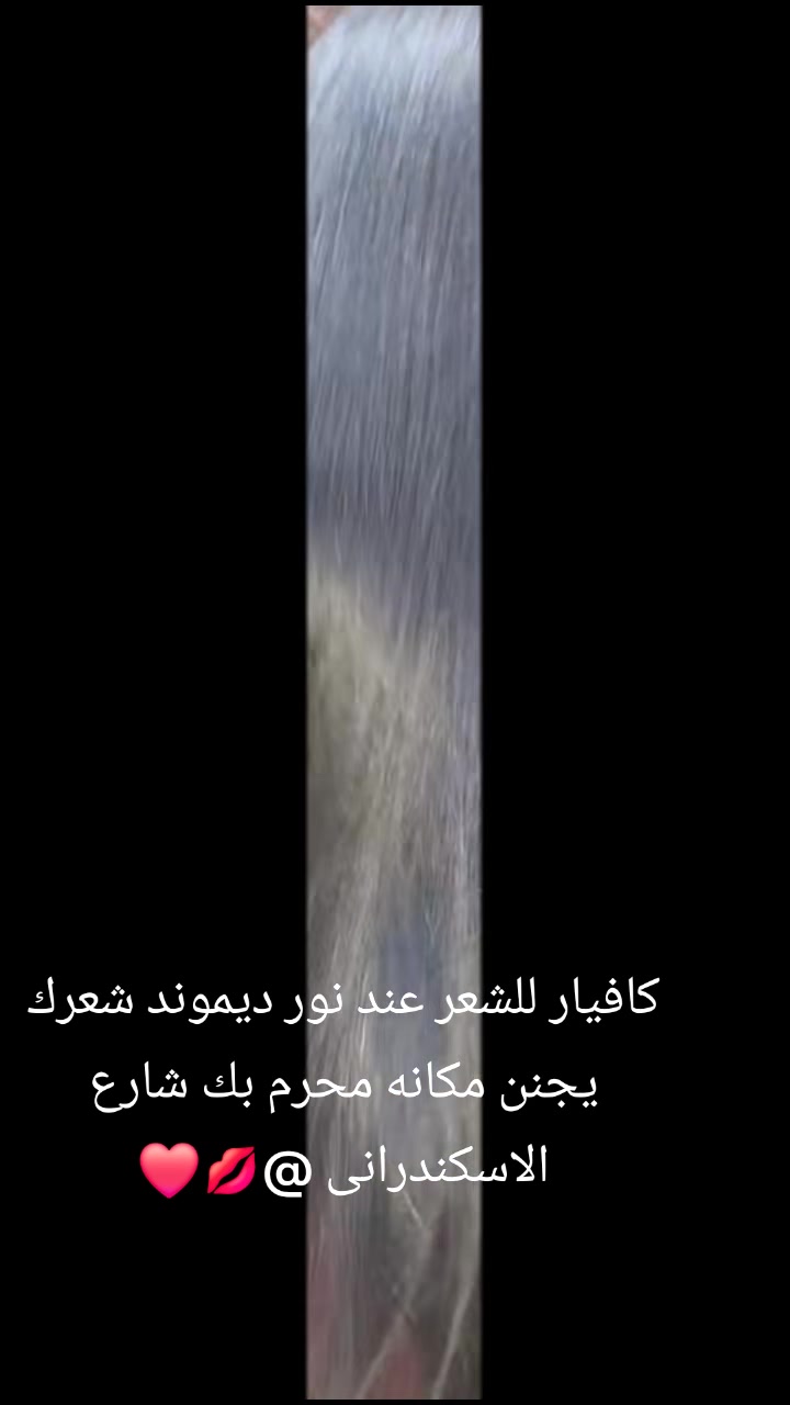 @Nour diamond ๐
