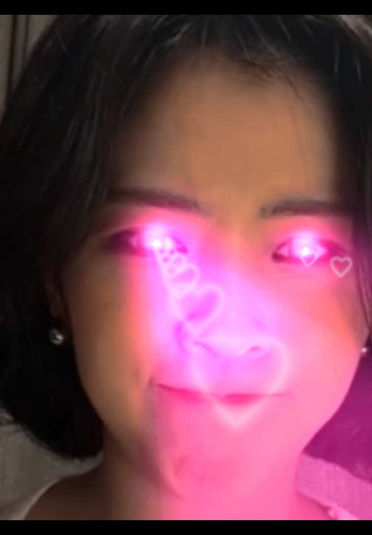 @rae has tunnel vision