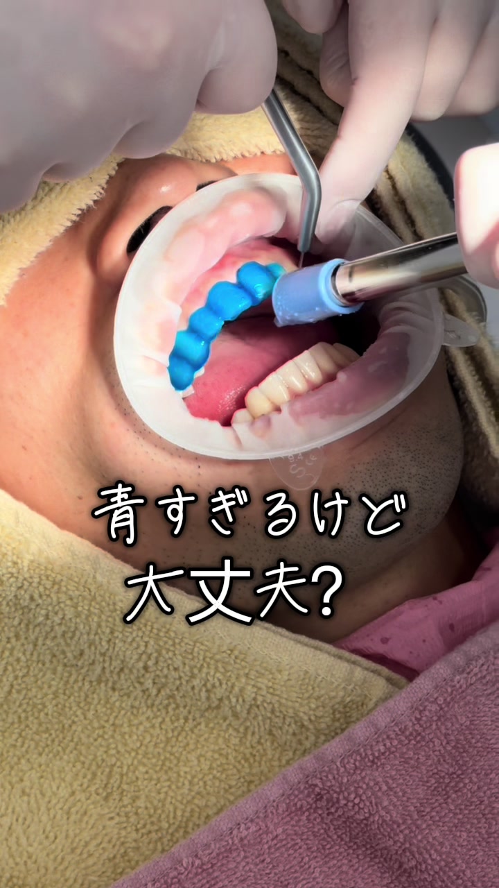 @DENTAL ALIEN
