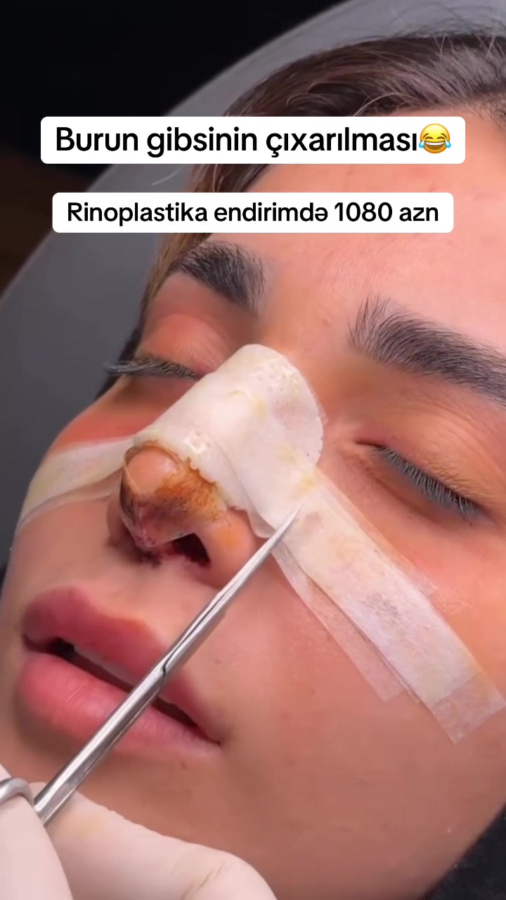 @Estetik_cerrah