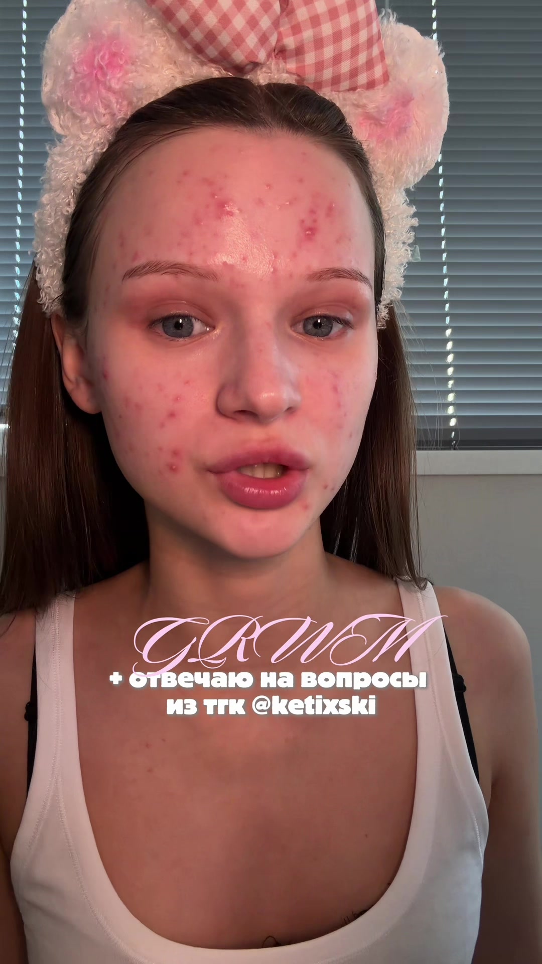 @кетикс