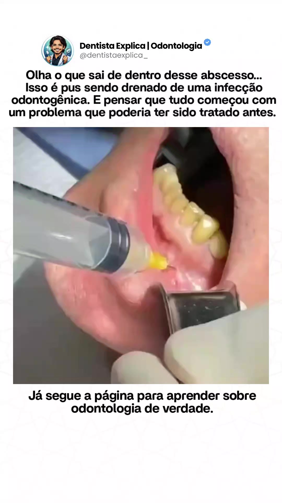 @Dentista Explica | Odontologia