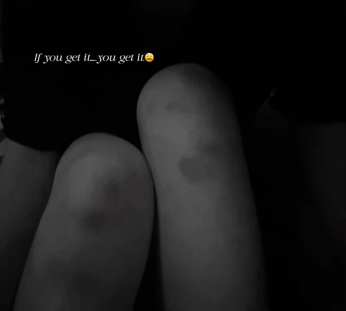 @A.