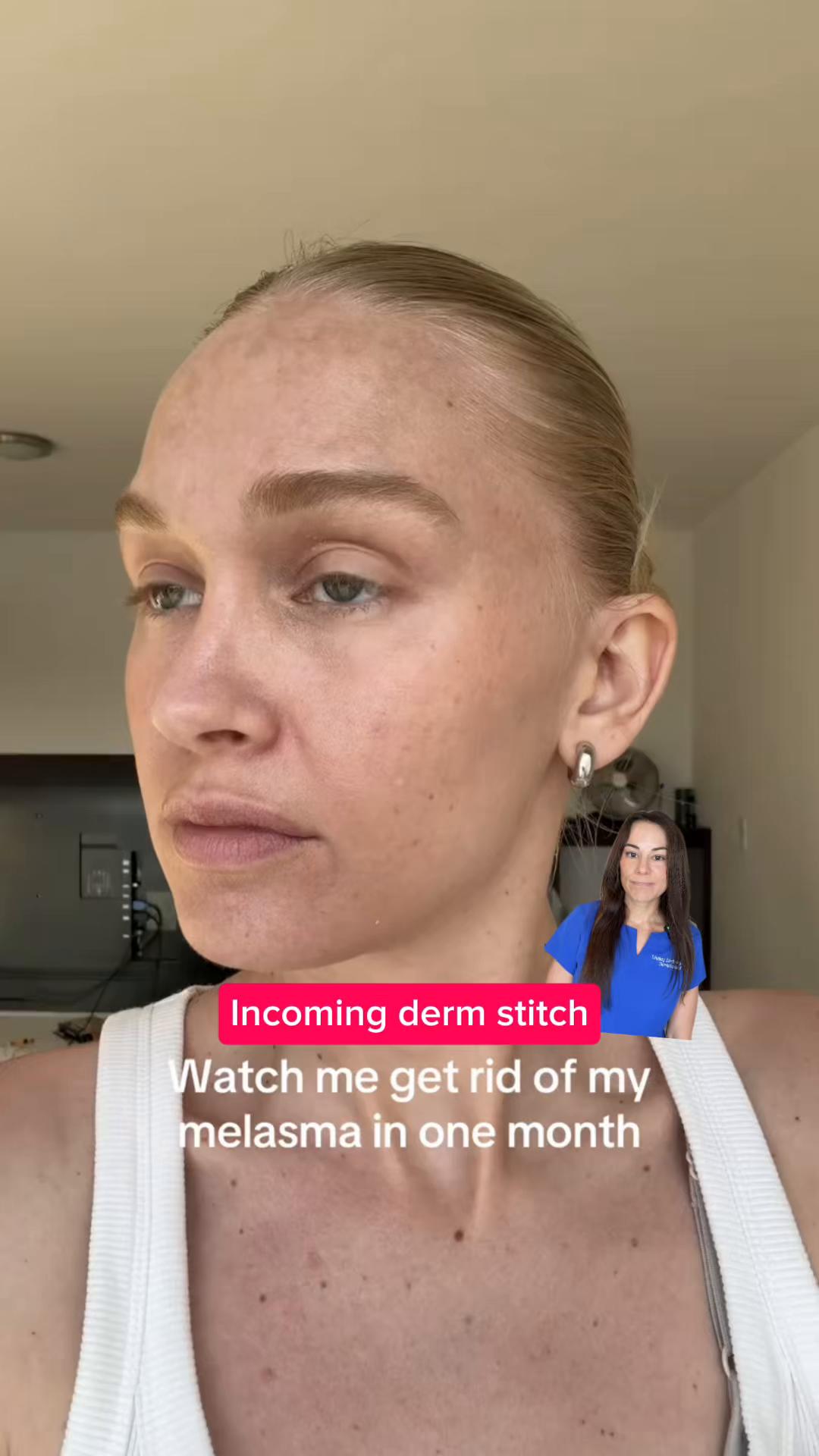 @Dermguru