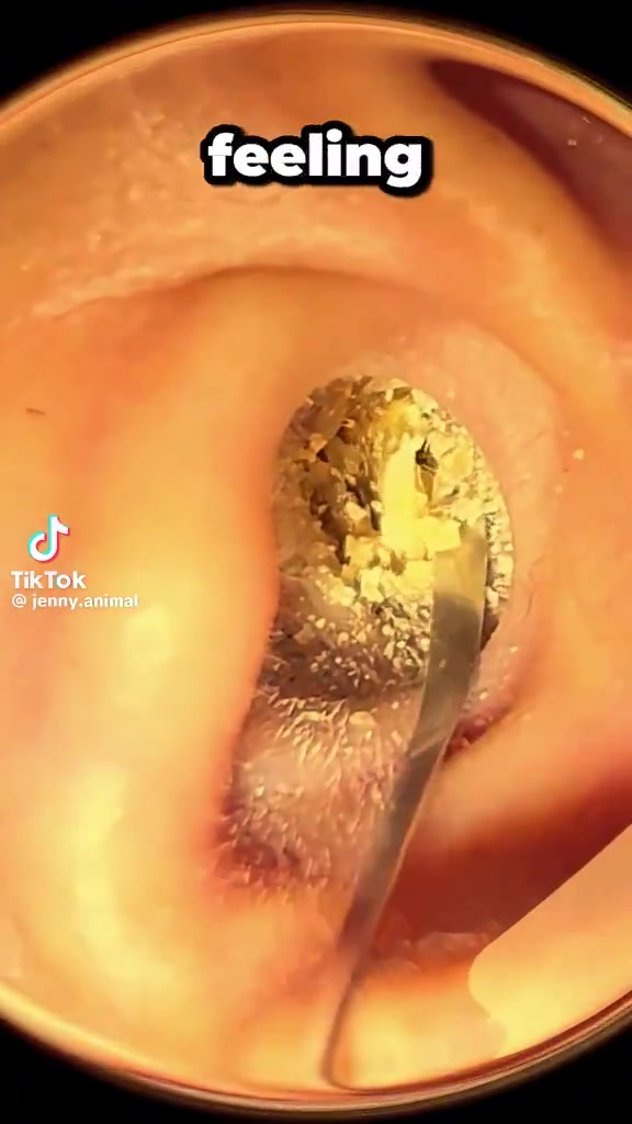 @Satisfying Ear Cleaning Videos