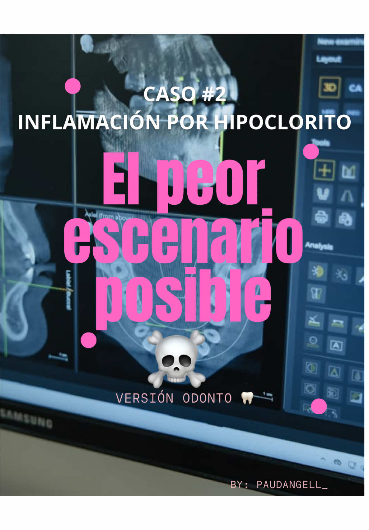@Pau en crocs 🦷
