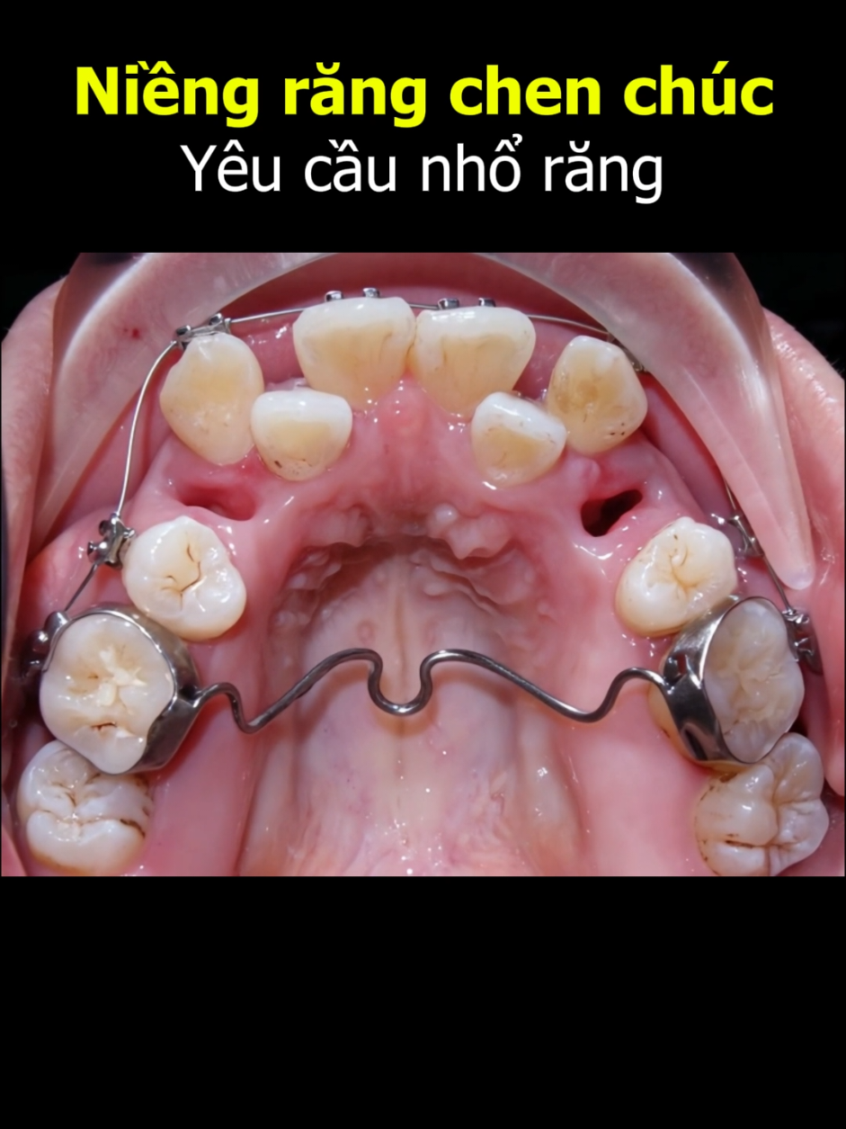 @Nha Khoa Ocare
