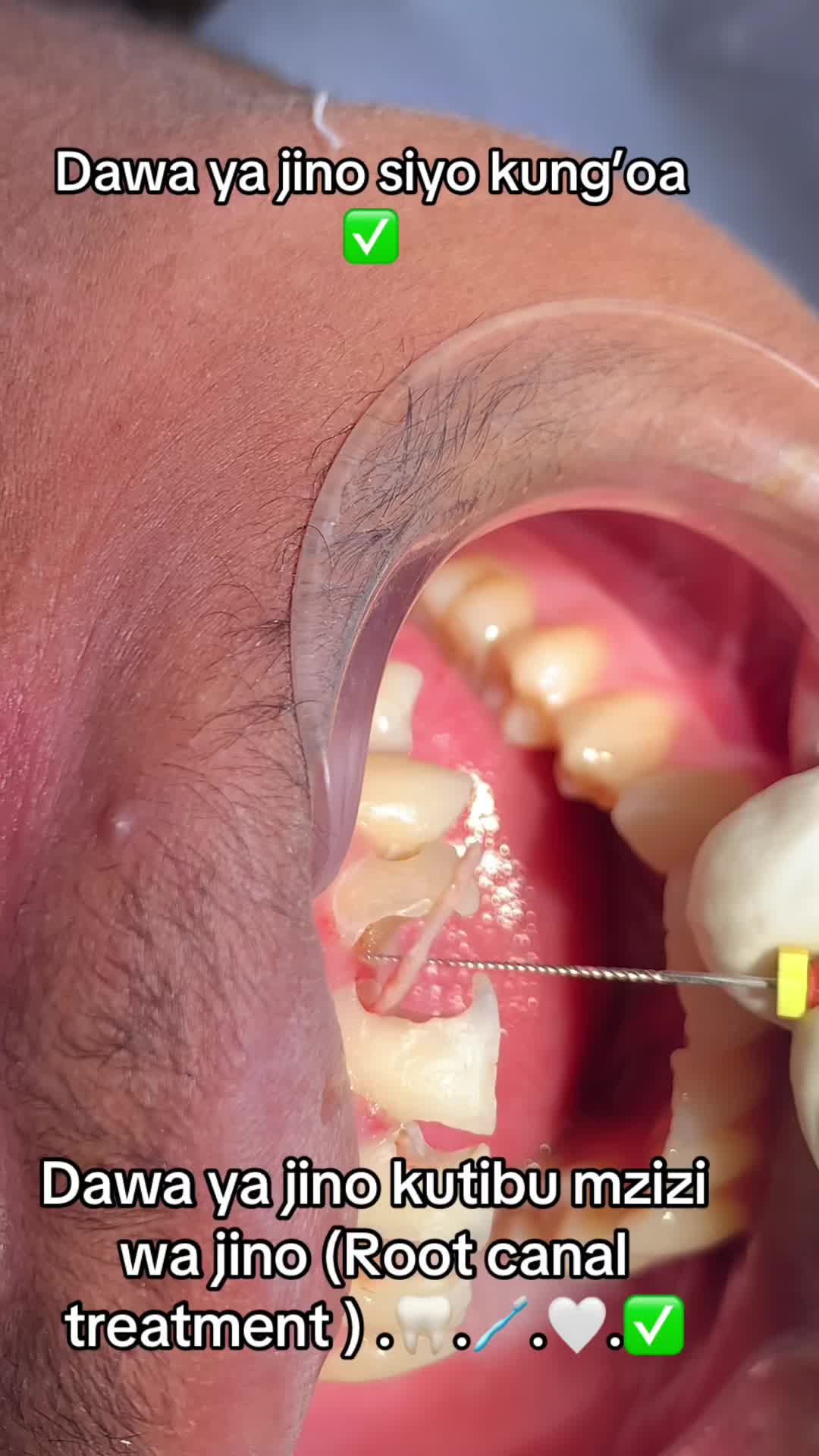 @Dentist_tn01