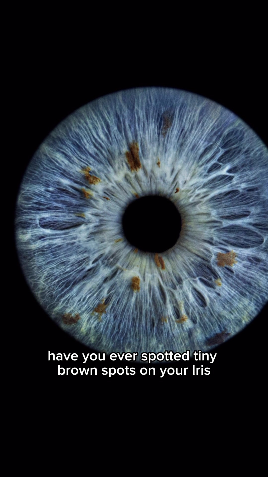 @Cosmic Eye