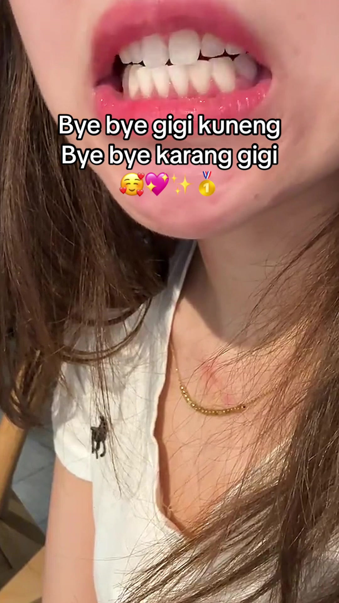 @Gigi Putih Berkilau🦷✨
