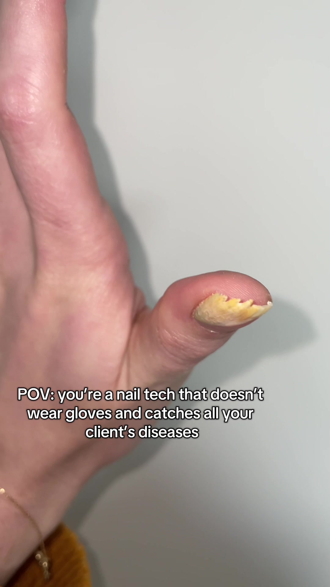 @Tappy Tips | Nail Artist ๐ป